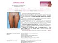Liposuccion des cuisses